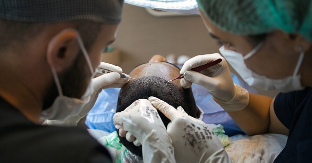 Fra skaldethed til tykt hår: Alt hvad du bør vide om hårtransplantation til mænd